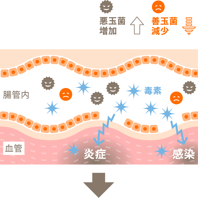 リーキーガット状態の腸壁